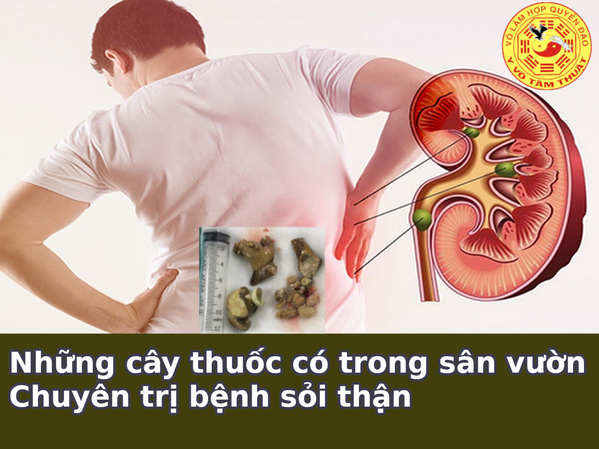 NHỮNG CÂY THUỐC CÓ TRONG VƯỜN NHÀ CHUYÊN TRỊ BỆNH SỎI THẬN, SỎI TIẾT NIỆU NHỮNG CÂY THUỐC CÓ TRONG VƯỜN NHÀ CHUYÊN TRỊ BỆNH SỎI THẬN, SỎI TIẾT NIỆU